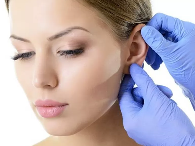 جراحی زیبایی گوش