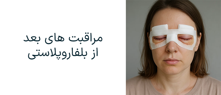 مراقبت های بعد بلفاروپلاستی