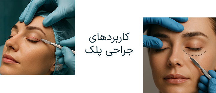 کاربردهای جراحی پلک