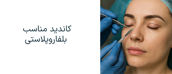 کاندید جراحی پلک