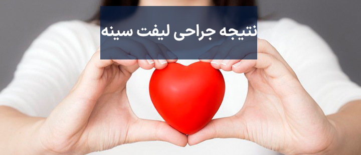 نتیجه جراحی لیفت سینه