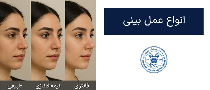 انواع عمل بینی