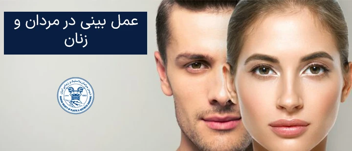 عمل بینی در مردان و زنان