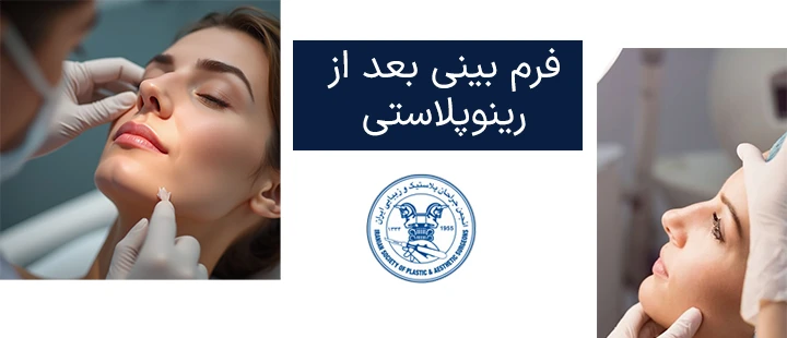 فرم بینی بعد از رینوپلاستی