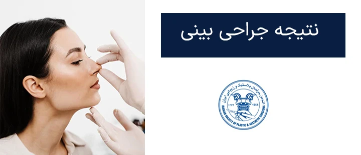 نتیجه جراحی بینی