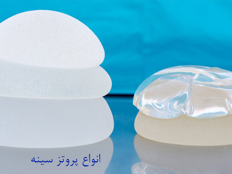 انواع پروتز سینه
