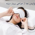 خوابیدن بعد از جراحی پروتز سینه