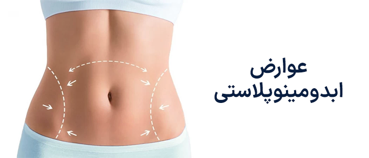 عوارض ابدومینوپلاستی
