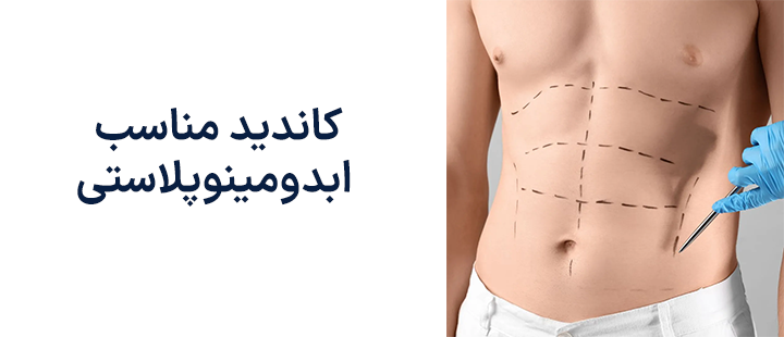 کاندید مناسب ابدومینوپلاستی