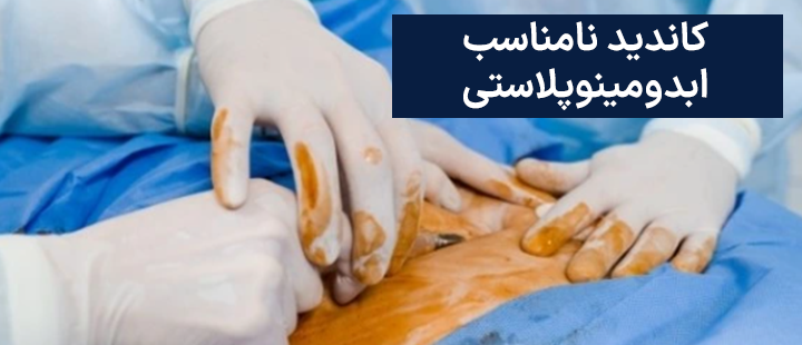 کاندید نامناسب ابدومینوپلاستی