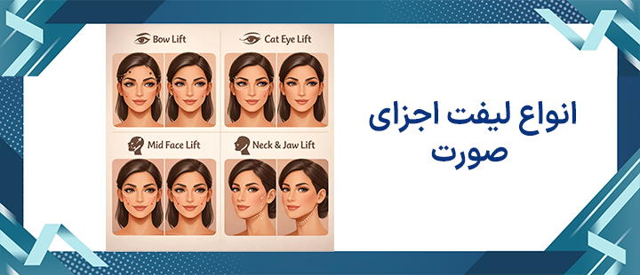 انواع لیفت اجرای صورت