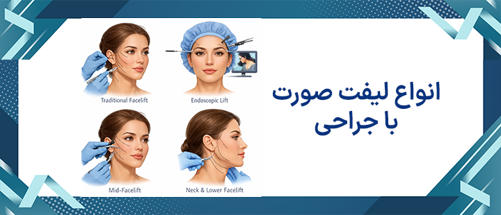 انواع لیفت صورت با جراحی