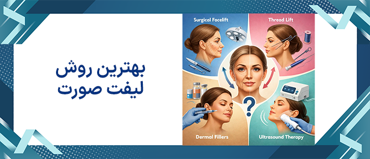 بهترین روش لیفت صورت