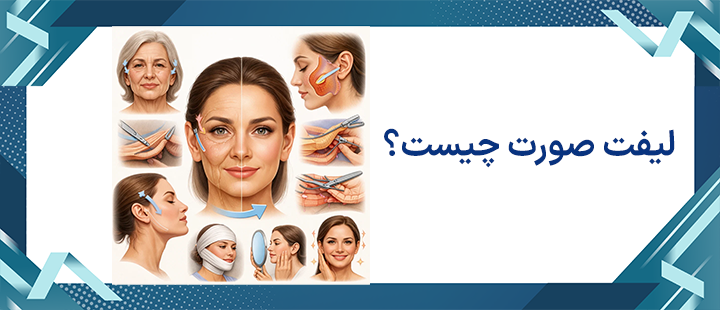 لیفت صورت چیست؟