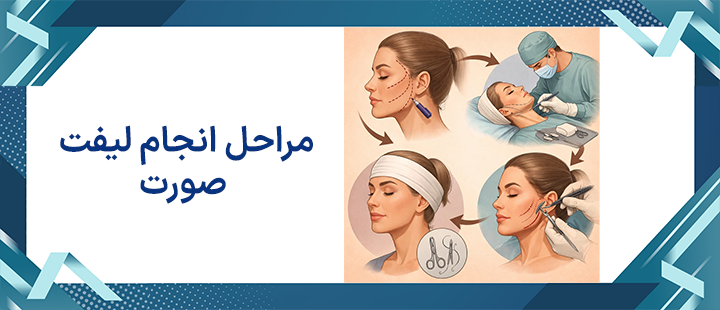 مراحل انجام لیفت صورت