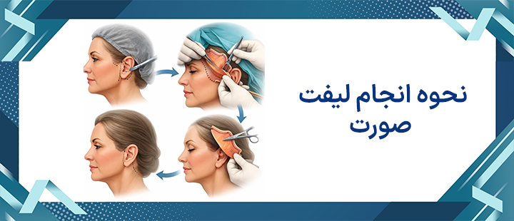 نحوه انجام لیفت صورت