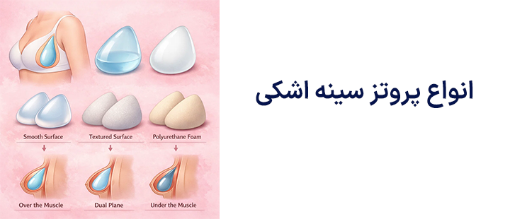 انواع پروتز سینه اشکی